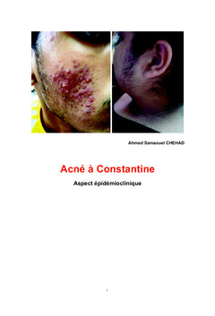 Acné à Constantine