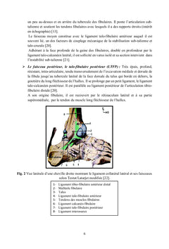 Le ligament de l'entorse latérale de la cheville