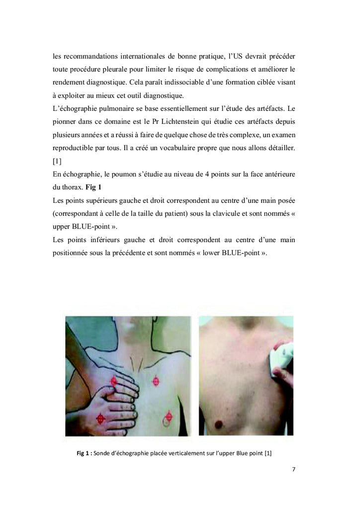 Echographie pleuropulmonaire chez le malade en état critique