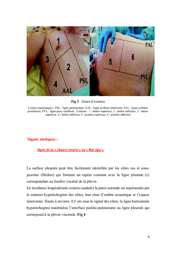 Echographie pleuropulmonaire chez le malade en état critique