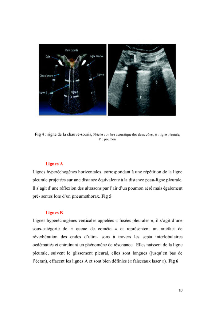 Echographie pleuropulmonaire chez le malade en état critique