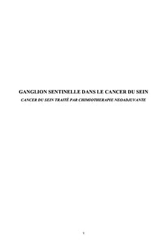 Ganglion sentinelle dans le cancer du sein