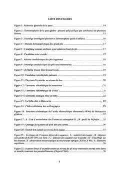 Les mycoses cutanées