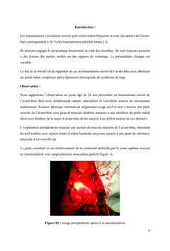 Les traumatismes vasculaires: cas cliniques