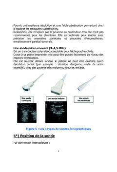 L'essentiel en échographie thoracique