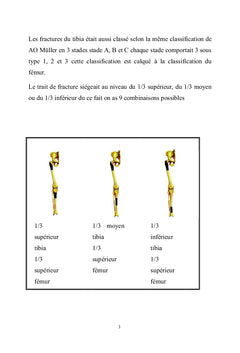 Le genou flottant : diagnostique et algorithme de prise en charge