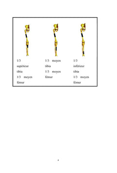 Le genou flottant : diagnostique et algorithme de prise en charge