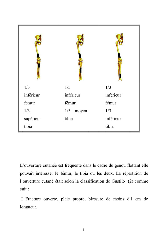 Le genou flottant : diagnostique et algorithme de prise en charge