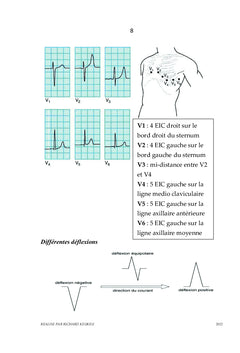 Aide-mémoire pour la lecture de l'électrocardiogramme pour étudiant