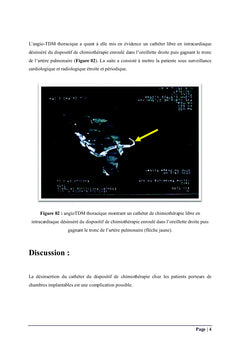 Collection myxomes: cas cliniques