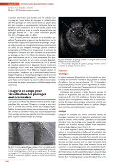 Traité d'imagerie cardiovasculaire