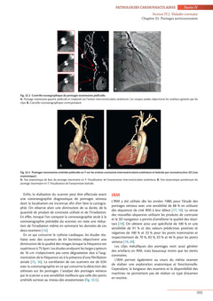 Traité d'imagerie cardiovasculaire