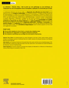 Rétine : atlas des maladies du fond d'oeil