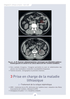 L'urologie facile aux EDN