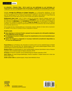 Rétinopathie diabétique