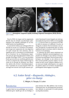 Conduites pratiques en médecine foetale