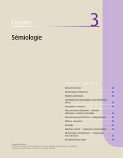 Rétinopathie diabétique