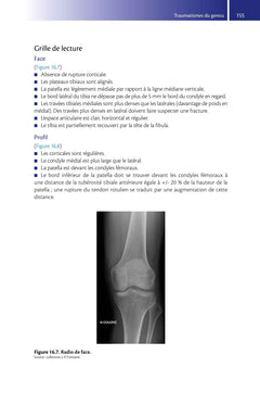Guide de traumatologie en médecine d'urgence