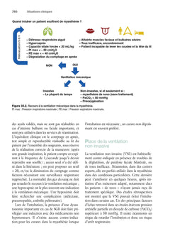 Ventilation artificielle