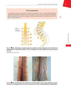 Neurochirurgie