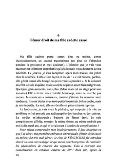L'usure