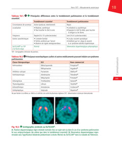 Neurologie