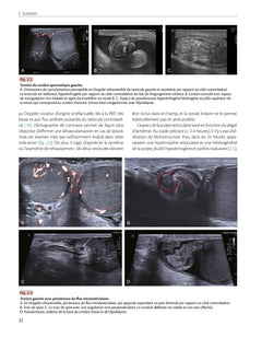 Imagerie de la prostate et des organes génitaux de l'homme