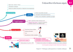 Diplôme Infirmier - DEI - Cartes mentales - Pathologies inflammatoires et infectieuses