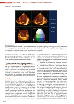 Insuffisance cardiaque