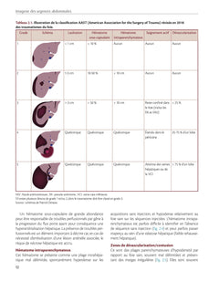 Imagerie des urgences abdominales