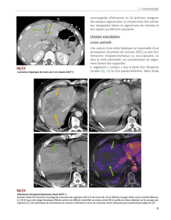Imagerie des urgences abdominales