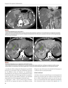 Imagerie des urgences abdominales