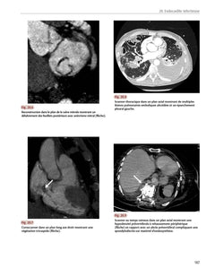 Radiologie cardiaque