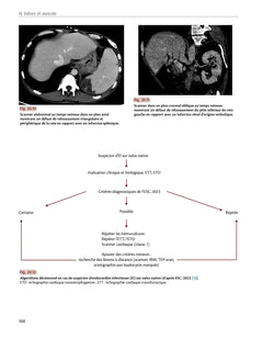 Radiologie cardiaque