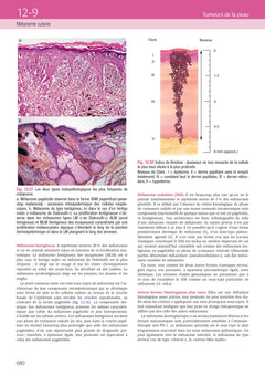 Dermatologie et infections sexuellement transmissibles