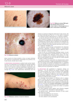Dermatologie et infections sexuellement transmissibles