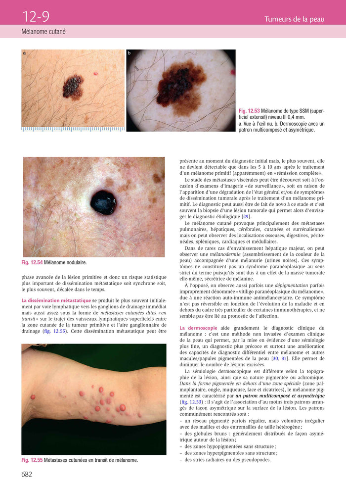 Dermatologie et infections sexuellement transmissibles