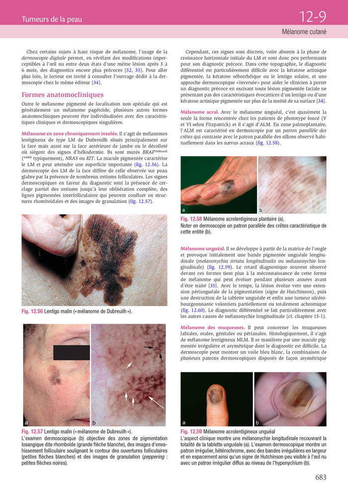 Dermatologie et infections sexuellement transmissibles