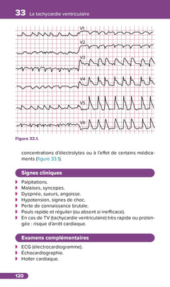 Fiches de soins infirmiers en cardiologie