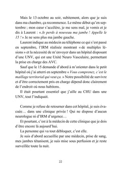 Trop jeune pour faire un AVC