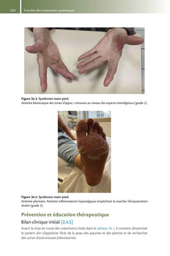 Tout-en-un d'oncologie