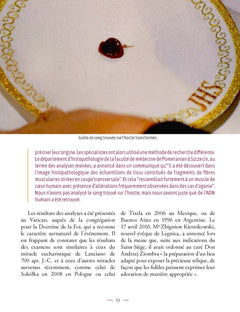 Les miracles eucharistiques dans le monde