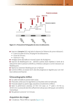 Guide pratique d'échocardiographie