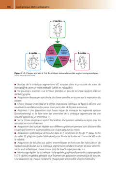 Guide pratique d'échocardiographie