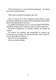 Écoute ma bipolarité