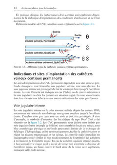 Accès vasculaires pour hémodialyse