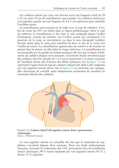Accès vasculaires pour hémodialyse
