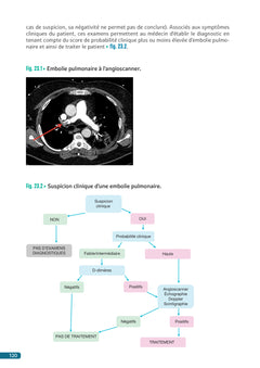 Situations prévalentes - Pneumologie
