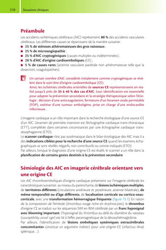 Guide de scanner cardiaque