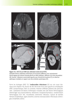 Guide de scanner cardiaque